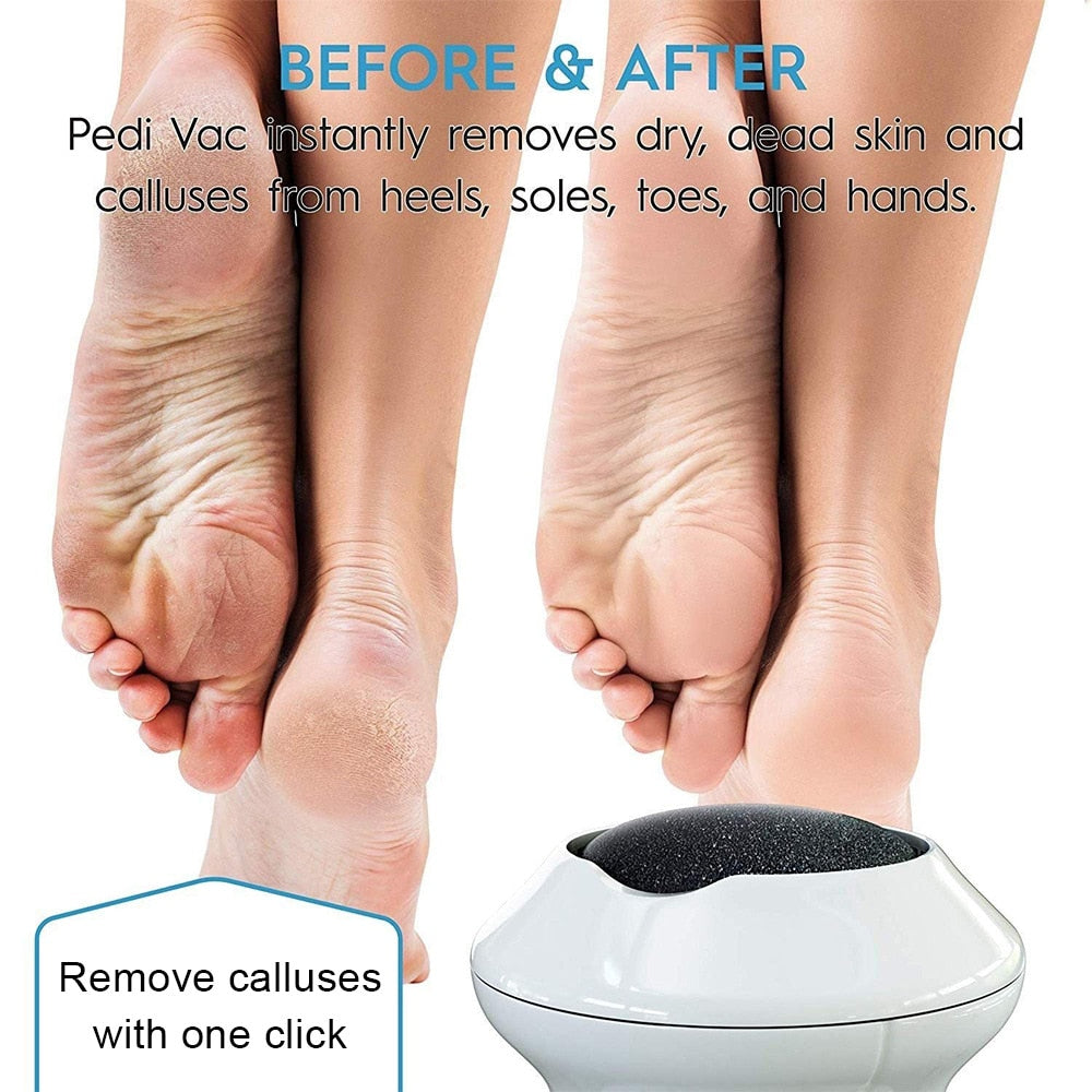 BROYEUR ELECTRIQUE POUR LES PIEDS A PEAU MORTE