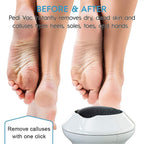 BROYEUR ELECTRIQUE POUR LES PIEDS A PEAU MORTE
