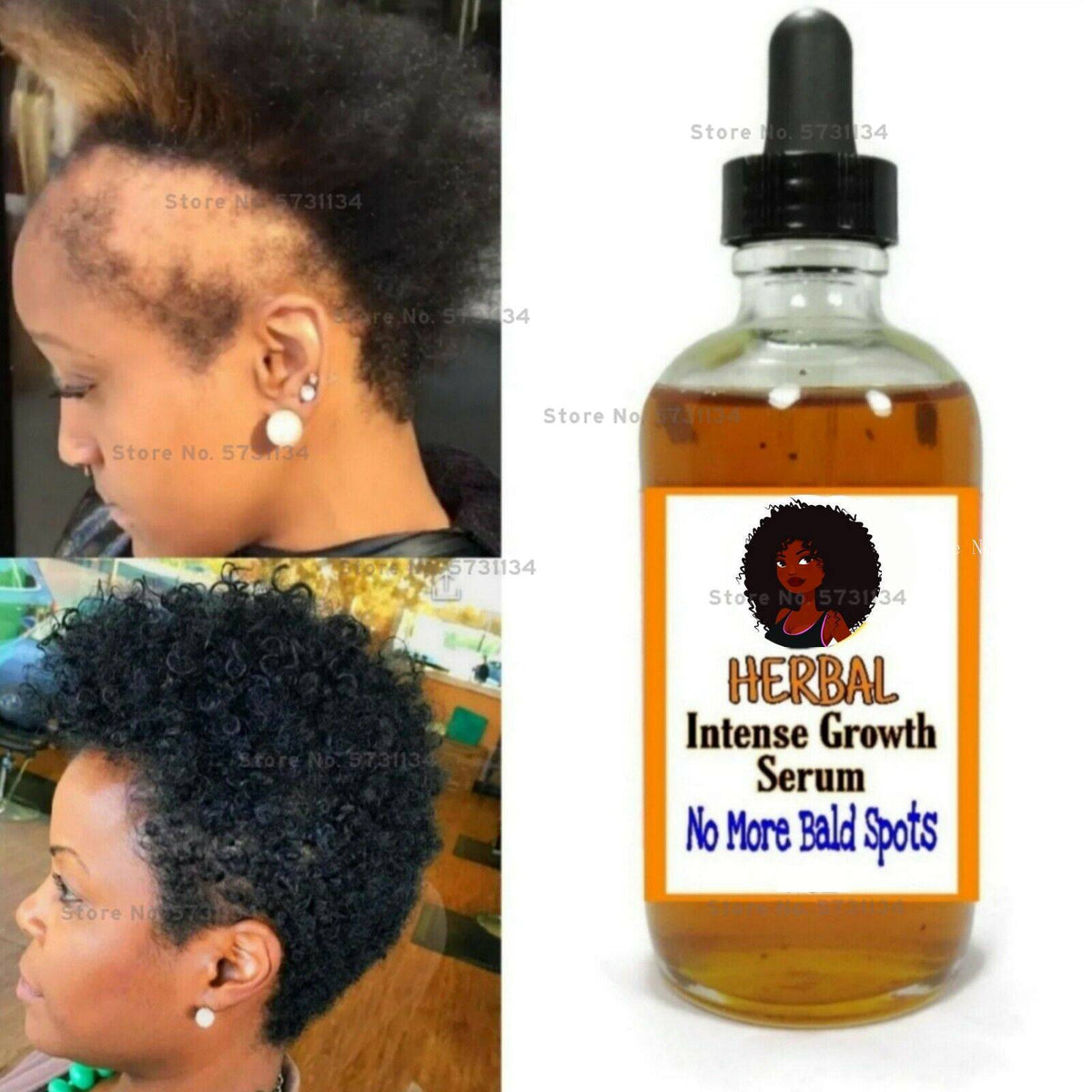 SERUM DE CROISSANCE DE CHEVEUX A L'HUILE DE RICIN DE GRAINE NOIRE(cheveux épais, croissance rapide 20ml ) - BOSSOUASHOP